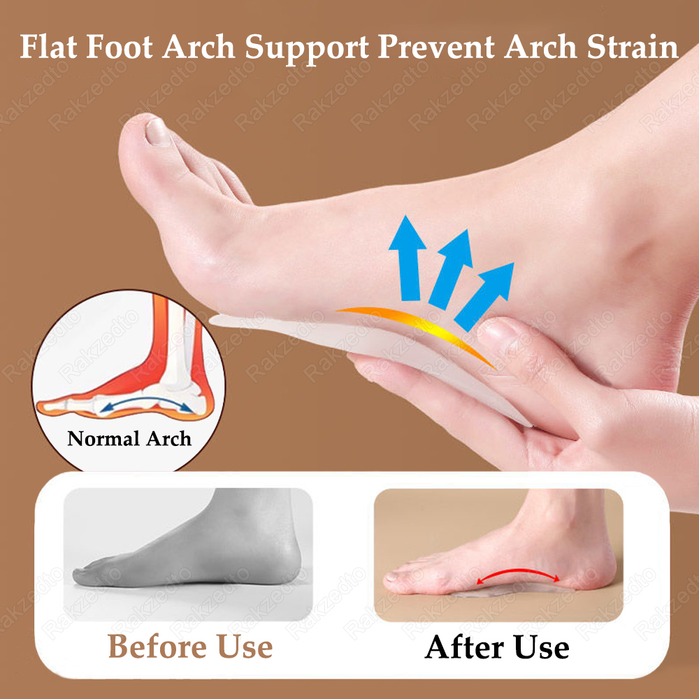 Silicone Shoe Pads Man Woman P - đánh giá và giá Women'S Shoes For Plantar Fasciitis
